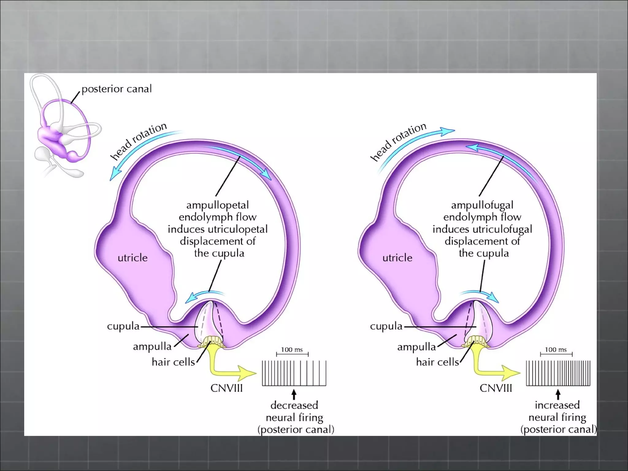 Bppv and particle repositioning maneuvers | PPT