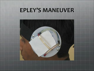 EPLEYEPLEY’S MANEUVER’S MANEUVER
 