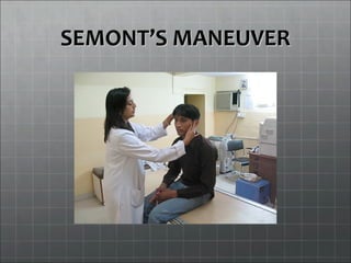 SEMONTSEMONT’S MANEUVER’S MANEUVER
 