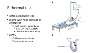 Bithermal test
• Fitzgerald hallpike test
• Supine with head elevated @
30 degrees
• In each ear is irrigated twice
• Once with cold water (30*c)
• Once with warm water (44*C)
• COWS
• Cold water opposite ear
• Warm water same ear
 