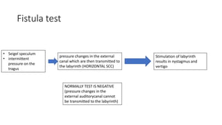Fistula test
• Seigel speculum
• intermittent
pressure on the
tragus
pressure changes in the external
canal which are then transmitted to
the labyrinth (HORIZONTAL SCC)
Stimulation of labyrinth
results in nystagmus and
vertigo
NORMALLY TEST IS NEGATIVE
(pressure changes in the
external auditorycanal cannot
be transmitted to the labyrinth)
 