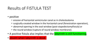Results of FISTULA TEST
• positive
• erosion of horizontal semicircular canal as in cholesteatoma
• surgically-created window in the horizontal canal (fenestration operation),
• abnormal opening in the oval window (post-stapedectomyfistula) or
• the round window (rupture of round window membrane).
• A positive fistula also implies that the labyrinth is still functioning;
• absent when labyrinth is dead.
 