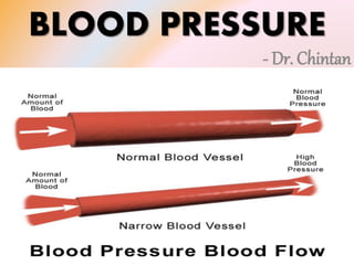 BLOOD PRESSURE
- Dr. Chintan
 