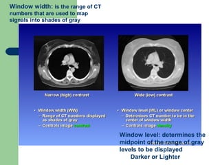 CT Physics | PPT