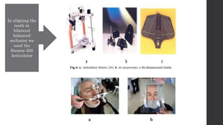 journal cub presentation on Bps denture/biofunctional prosthetic system ...