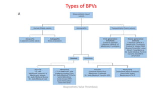 Types of BPVs
Bioprosthetic Valve Thrombosis
 