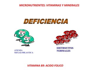 MICRONUTRIENTES: VITAMINAS Y MINERALES
VITAMINA B9: ACIDO FOLICO
 