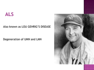Also known as LOU GEHRIG’S DISEASE
Degeneration of UMN and LMN
 
