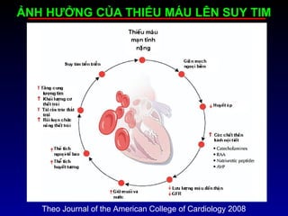 ẢNH HƯỞNG CỦA THIẾU MÁU LÊN SUY TIM
Theo Journal of the American College of Cardiology 2008
 