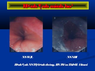 NSW/L NSNBI
H×nh¶nhNSTQb×nhth­êng, BN Ph¹mThÞH, 44tuæi
H×nh ¶nh minh ho¹H×nh ¶nh minh ho¹
 