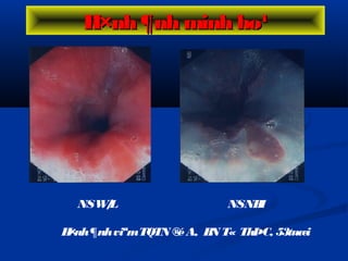 NSW/L NSNBI
H×nh¶nhviªmTQTN ®éA, BN T« ThÞC, 53tuæi
H×nh ¶nh minh ho¹H×nh ¶nh minh ho¹
 