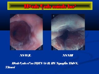 NSW/L NSNBI
H×nh¶nhviªmTQTN ®éB, BN NguyÔnThÞN,
73tuæi
H×nh ¶nh minh ho¹H×nh ¶nh minh ho¹
 