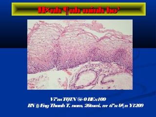ViªmTQTN ®é0HEx100
BN §ÆngThanhT, nam, 26tuæi, m· tiªub¶nY1209
H×nh ¶nh minh ho¹H×nh ¶nh minh ho¹
 
