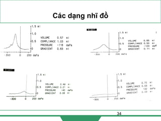 34
Các dạng nhĩ đồ
 