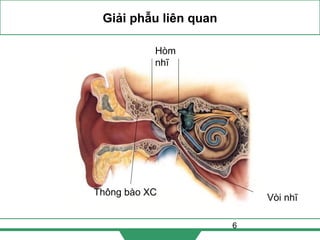 6
Giải phẫu liên quan
Hòm
nhĩ
Thông bào XC
Vòi nhĩ
 