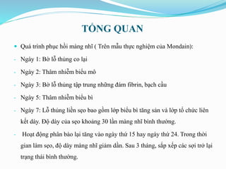 TỔNG QUAN
 Quá trình phục hồi màng nhĩ ( Trên mẫu thực nghiệm của Mondain):
- Ngày 1: Bờ lỗ thủng co lại
- Ngày 2: Thâm nhiễm biểu mô
- Ngày 3: Bờ lỗ thủng tập trung những đám fibrin, bạch cầu
- Ngày 5: Thâm nhiễm biểu bì
- Ngày 7: Lỗ thủng liền sẹo bao gồm lớp biểu bì tăng sản và lớp tổ chức liên
kết dày. Độ dày của sẹo khoảng 30 lần màng nhĩ bình thường.
- Hoạt động phân bào lại tăng vào ngày thứ 15 hay ngày thứ 24. Trong thời
gian làm sẹo, độ dày màng nhĩ giảm dần. Sau 3 tháng, sắp xếp các sợi trở lại
trạng thái bình thường.
 