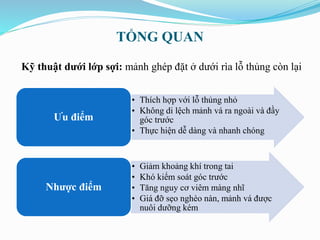 TỔNG QUAN
• Thích hợp với lỗ thủng nhỏ
• Không di lệch mảnh vá ra ngoài và đầy
góc trước
• Thực hiện dễ dàng và nhanh chóng
Ưu điểm
• Giảm khoảng khí trong tai
• Khó kiểm soát góc trước
• Tăng nguy cơ viêm màng nhĩ
• Giá đỡ sẹo nghèo nàn, mảnh vá được
nuôi dưỡng kém
Nhược điểm
Kỹ thuật dưới lớp sợi: mảnh ghép đặt ở dưới rìa lỗ thủng còn lại
 