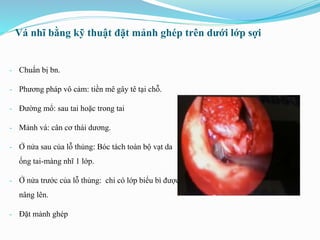 Vá nhĩ bằng kỹ thuật đặt mảnh ghép trên dưới lớp sợi
- Chuẩn bị bn.
- Phương pháp vô cảm: tiền mê gây tê tại chỗ.
- Đường mổ: sau tai hoặc trong tai
- Mảnh vá: cân cơ thái dương.
- Ở nửa sau của lỗ thủng: Bóc tách toàn bộ vạt da
ống tai-màng nhĩ 1 lớp.
- Ở nửa trước của lỗ thủng: chỉ có lớp biểu bì được
nâng lên.
- Đặt mảnh ghép
 