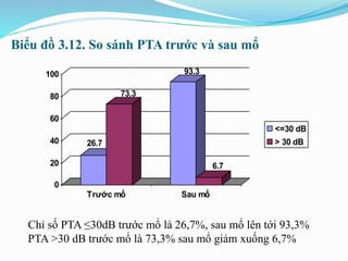 Biểu đồ 3.12. So sánh PTA trước và sau mổ
Chỉ số PTA ≤30dB trước mổ là 26,7%, sau mổ lên tới 93,3%
PTA >30 dB trước mổ là 73,3% sau mổ giảm xuống 6,7%
26.7
73.3
93.3
6.7
0
20
40
60
80
100
Trước mổ Sau mổ
<=30 dB
> 30 dB
 