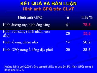 KẾT QUẢ VÀ BÀN LUẬNKẾT QUẢ VÀ BÀN LUẬN
Hình ảnh GPQ trên CLVTHình ảnh GPQ trên CLVT
Hoàng Minh Lợi (2001): ống sáng 91,5%; tổ ong 26,8%, hình GPQ trong ổ
đông đặc 42,7%
Hình ảnh GPQ n Tỉ lệ %
Hình đường ray, hình ống sáng 41 78,8
Hình tròn sáng (hình nhẫn, con
dấu)
29 55,8
Hình tổ ong, chùm nho 14 26,9
Hình GPQ trong ổ đông đặc phổi 20 38,5
 