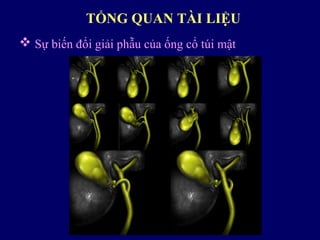  Sự biến đổi giải phẫu của ống cổ túi mật
TỔNG QUAN TÀI LIỆU
 