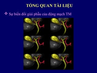  Sự biến đổi giải phẫu của động mạch TM
TỔNG QUAN TÀI LIỆU
 