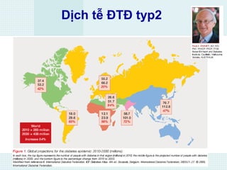 Dịch tễ ĐTĐ typ2
 
