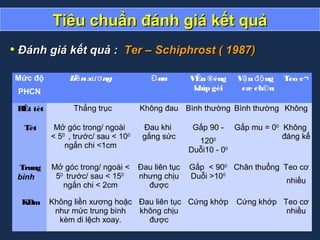 Tiêu chuẩn đánh giá kết quảTiêu chuẩn đánh giá kết quả
• Đánh giá kết quả :Đánh giá kết quả : Ter – Schiphrost ( 1987)Ter – Schiphrost ( 1987)
Mức độ
PHCN
Li nx ngề ươ auĐ VËn ®éng
khíp gèi
V n ngậ độ
cæ ch©n
Teo c¬
RÊt tèt Thẳng trục Không đau Bình thường Bình thường Không
Tèt Mở góc trong/ ngoài
< 50
, trước/ sau < 100
ngắn chi <1cm
Đau khi
gắng sức
Gấp 90 -
1200
Duỗi10 - 00
Gấp mu = 00
Không
đáng kể
Trung
bình
Mở góc trong/ ngoài <
50
trước/ sau < 150
ngắn chi < 2cm
Đau liên tục
nhưng chịu
được
Gấp < 900
Duỗi >100
Chân thuổng Teo cơ
nhiều
KÐm Không liền xương hoặc
như mức trung bình
kèm di lệch xoay.
Đau liên tục
không chịu
được
Cứng khớp Cứng khớp Teo cơ
nhiều
 