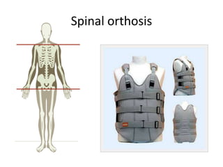 Spinal orthosis
