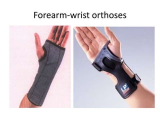 Forearm-wrist orthoses