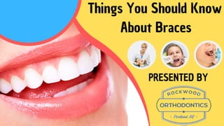 Things You Should Know
About Braces
PRESENTED BY
 