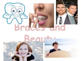 Braces and
Beauty
 