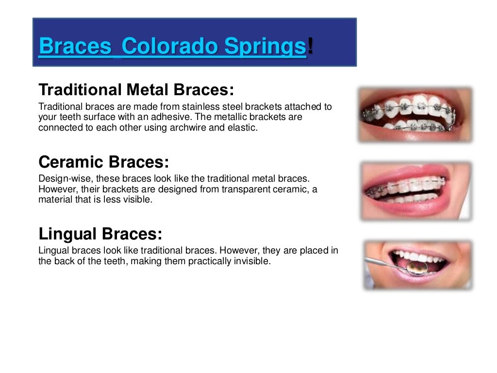 Orthodontist Colorado Orthodontic Experts of Colorado