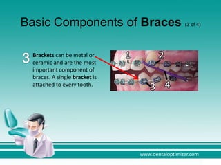 The Facts about Dental Braces | PPTX