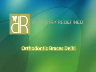 Orthodontic Braces Delhi

 