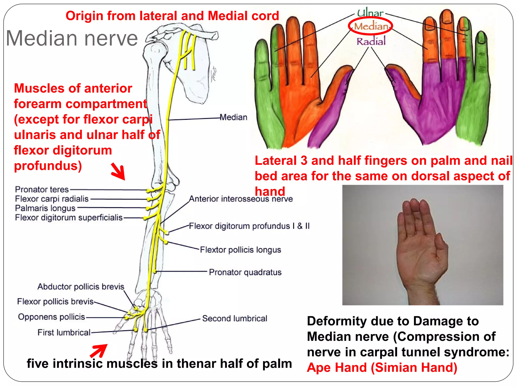 Median nerve
Lateral 3 and half fingers on palm and nail
bed area for the same on dorsal aspect of
hand
Muscles of anterior
forearm compartment
(except for flexor carpi
ulnaris and ulnar half of
flexor digitorum
profundus)
five intrinsic muscles in thenar half of palm
Deformity due to Damage to
Median nerve (Compression of
nerve in carpal tunnel syndrome:
Ape Hand (Simian Hand)
Origin from lateral and Medial cord
 