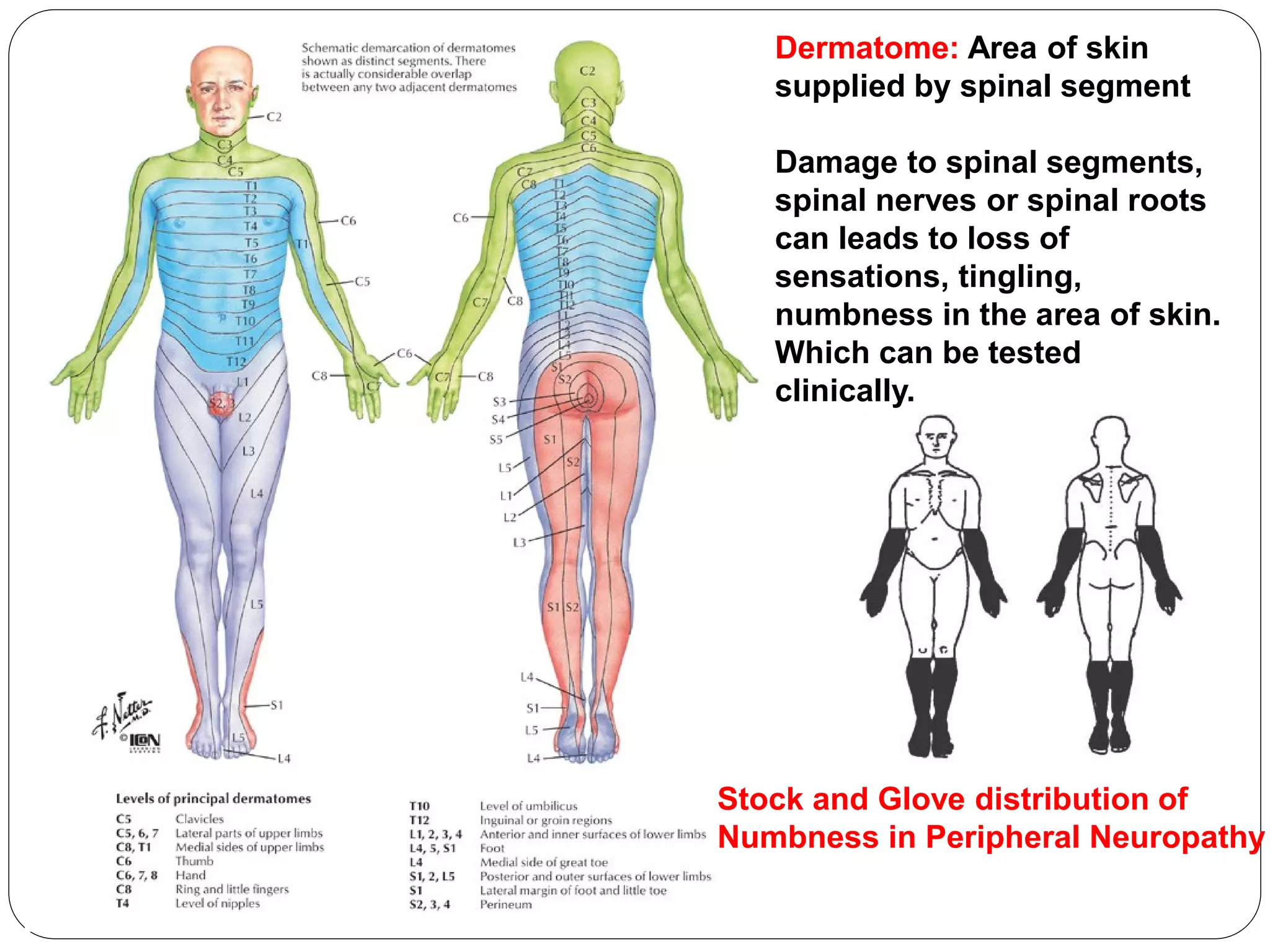 Dermatome: Area of skin
supplied by spinal segment
Damage to spinal segments,
spinal nerves or spinal roots
can leads to loss of
sensations, tingling,
numbness in the area of skin.
Which can be tested
clinically.
Stock and Glove distribution of
Numbness in Peripheral Neuropathy
 