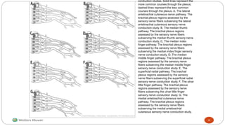 conduction studies. Solid lines represent the
more common courses through the plexus;
dashed lines represent the less common
courses through the plexus. A, The lateral
antebrachial cutaneous nerve pathway. The
brachial plexus regions assessed by the
sensory nerve fibers subserving the lateral
antebrachial cutaneous sensory nerve
conduction study. B, The median thumb
pathway. The brachial plexus regions
assessed by the sensory nerve fibers
subserving the median thumb sensory nerve
conduction study. C, The median index
finger pathway. The brachial plexus regions
assessed by the sensory nerve fibers
subserving the median index finger sensory
nerve conduction study. D, The median
middle finger pathway. The brachial plexus
regions assessed by the sensory nerve
fibers subserving the median middle finger
sensory nerve conduction study. E, The
superficial radial pathway. The brachial
plexus regions assessed by the sensory
nerve fibers subserving the superficial radial
sensory nerve conduction study. F, The ulnar
little finger pathway. The brachial plexus
regions assessed by the sensory nerve
fibers subserving the ulnar little finger
sensory nerve conduction study. G, The
medial antebrachial cutaneous nerve
pathway. The brachial plexus regions
assessed by the sensory nerve fibers
subserving the medial antebrachial
cutaneous sensory nerve conduction study.
30
 