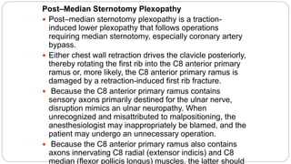 Post–Median Sternotomy Plexopathy
 Post–median sternotomy plexopathy is a traction-
induced lower plexopathy that follows operations
requiring median sternotomy, especially coronary artery
bypass.
 Either chest wall retraction drives the clavicle posteriorly,
thereby rotating the first rib into the C8 anterior primary
ramus or, more likely, the C8 anterior primary ramus is
damaged by a retraction-induced first rib fracture.
 Because the C8 anterior primary ramus contains
sensory axons primarily destined for the ulnar nerve,
disruption mimics an ulnar neuropathy. When
unrecognized and misattributed to malpositioning, the
anesthesiologist may inappropriately be blamed, and the
patient may undergo an unnecessary operation.
 Because the C8 anterior primary ramus also contains
axons innervating C8 radial (extensor indicis) and C8
median (flexor pollicis longus) muscles, the latter should
 