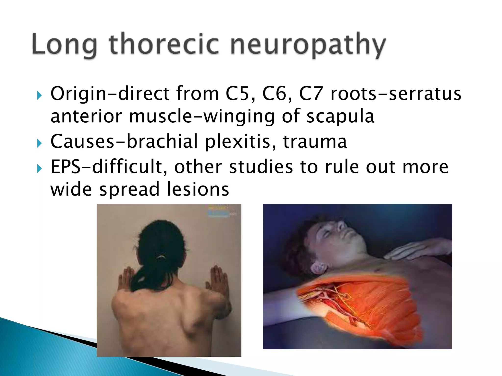  Origin-direct from C5, C6, C7 roots-serratus
anterior muscle-winging of scapula
 Causes-brachial plexitis, trauma
 EPS-difficult, other studies to rule out more
wide spread lesions
 
