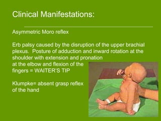 Clinical Manifestations:
Asymmetric Moro reflex
Erb palsy caused by the disruption of the upper brachial
plexus. Posture of adduction and inward rotation at the
shoulder with extension and pronation
at the elbow and flexion of the
fingers = WAITER’S TIP
Klumpke= absent grasp reflex
of the hand
 
