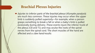 Fall Plexus Event Brachial plexus | PPTX