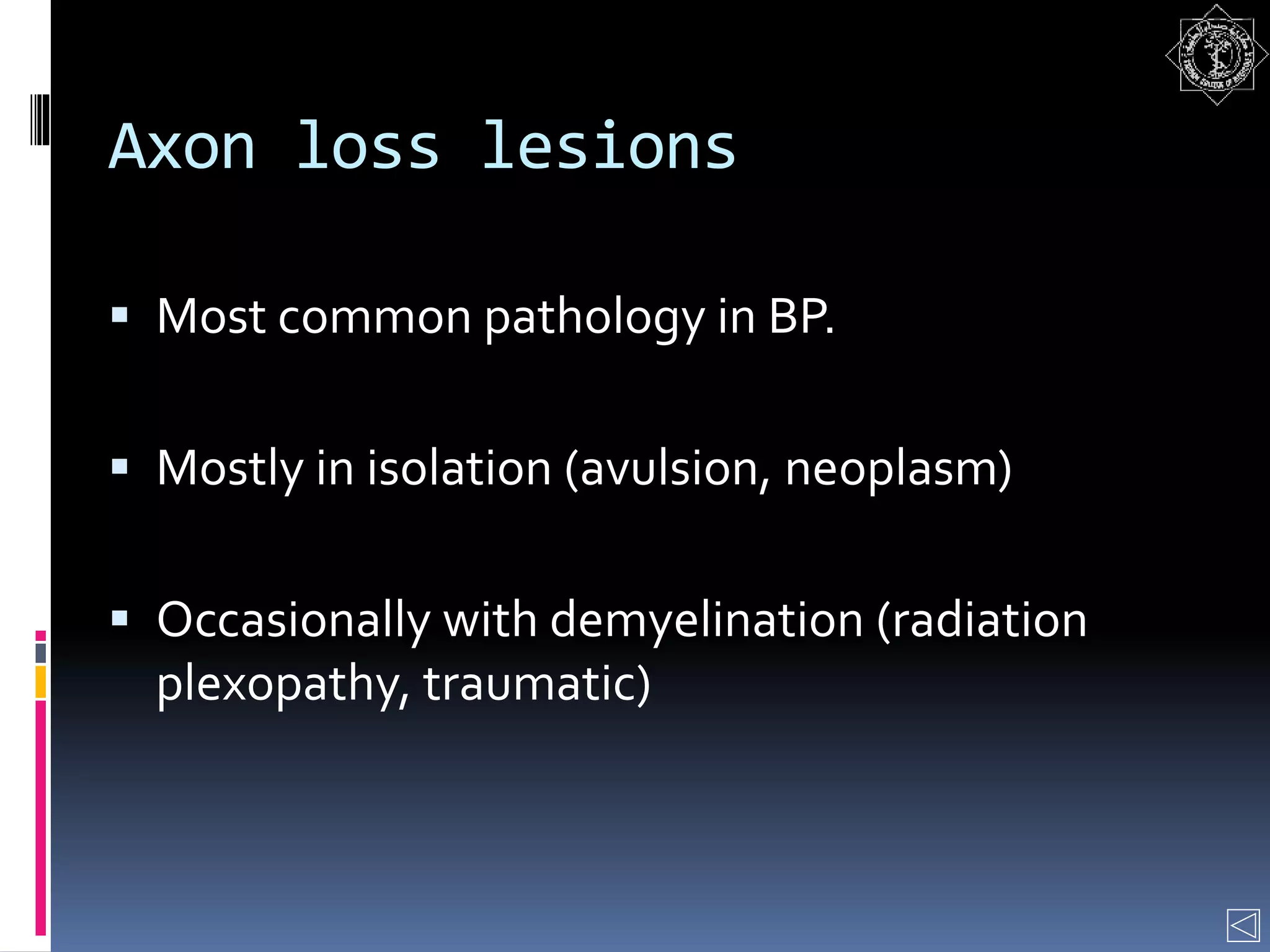 Axon loss lesions
 Most common pathology in BP.
 Mostly in isolation (avulsion, neoplasm)
 Occasionally with demyelination (radiation
plexopathy, traumatic)
 