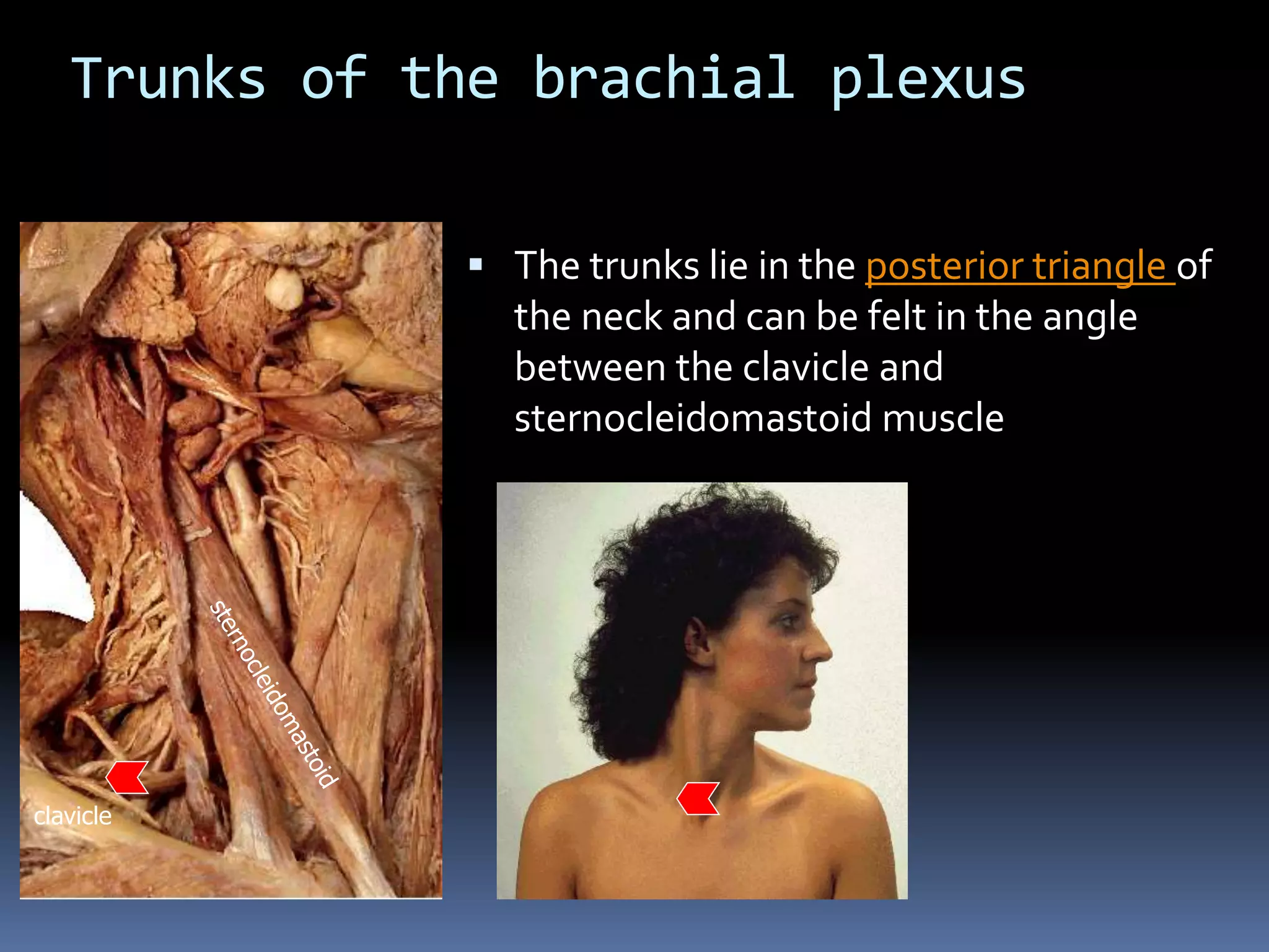Trunks of the brachial plexus
 The trunks lie in the posterior triangle of
the neck and can be felt in the angle
between the clavicle and
sternocleidomastoid muscle
clavicle
 