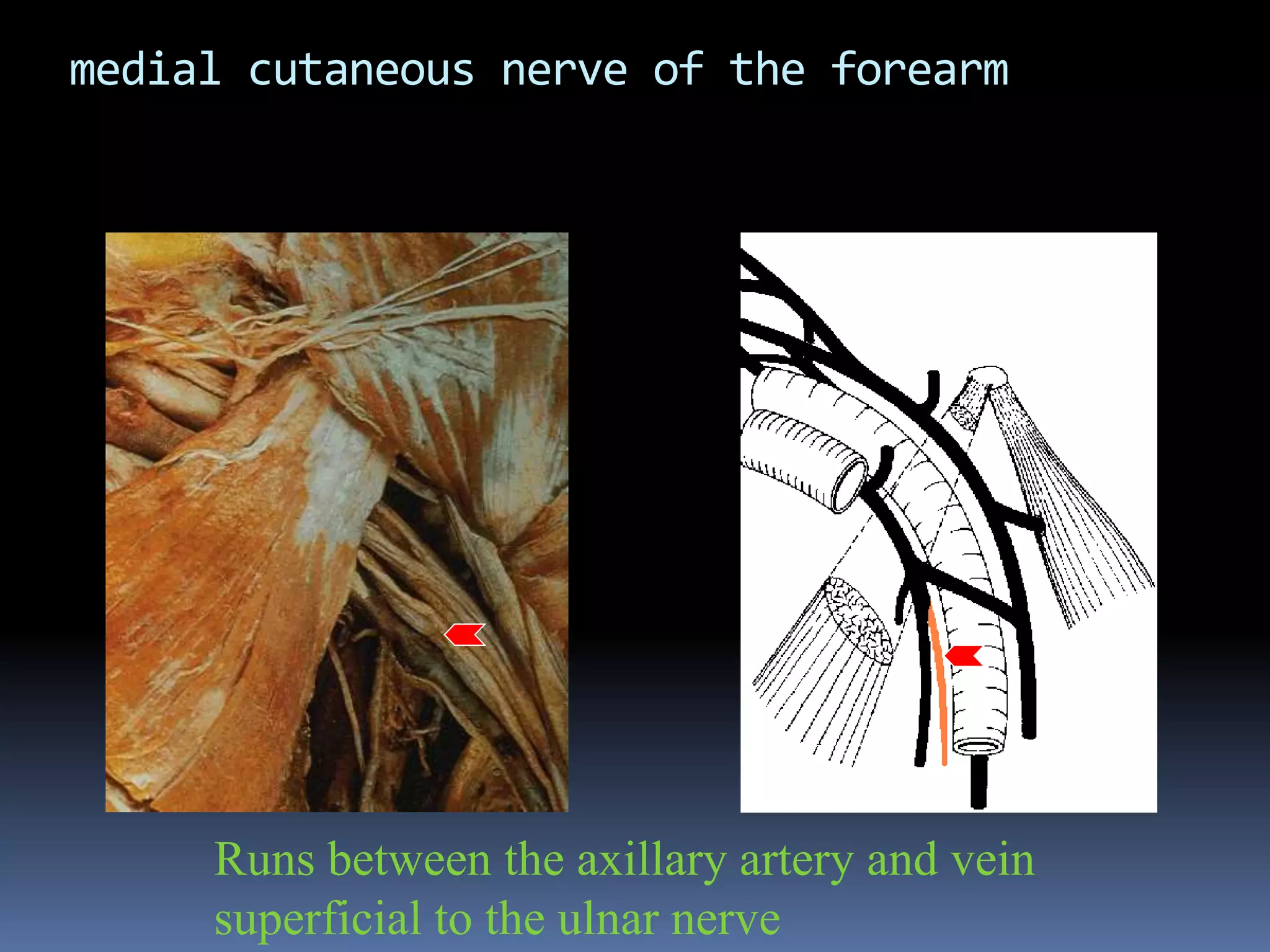 medial cutaneous nerve of the forearm
Runs between the axillary artery and vein
superficial to the ulnar nerve
 
