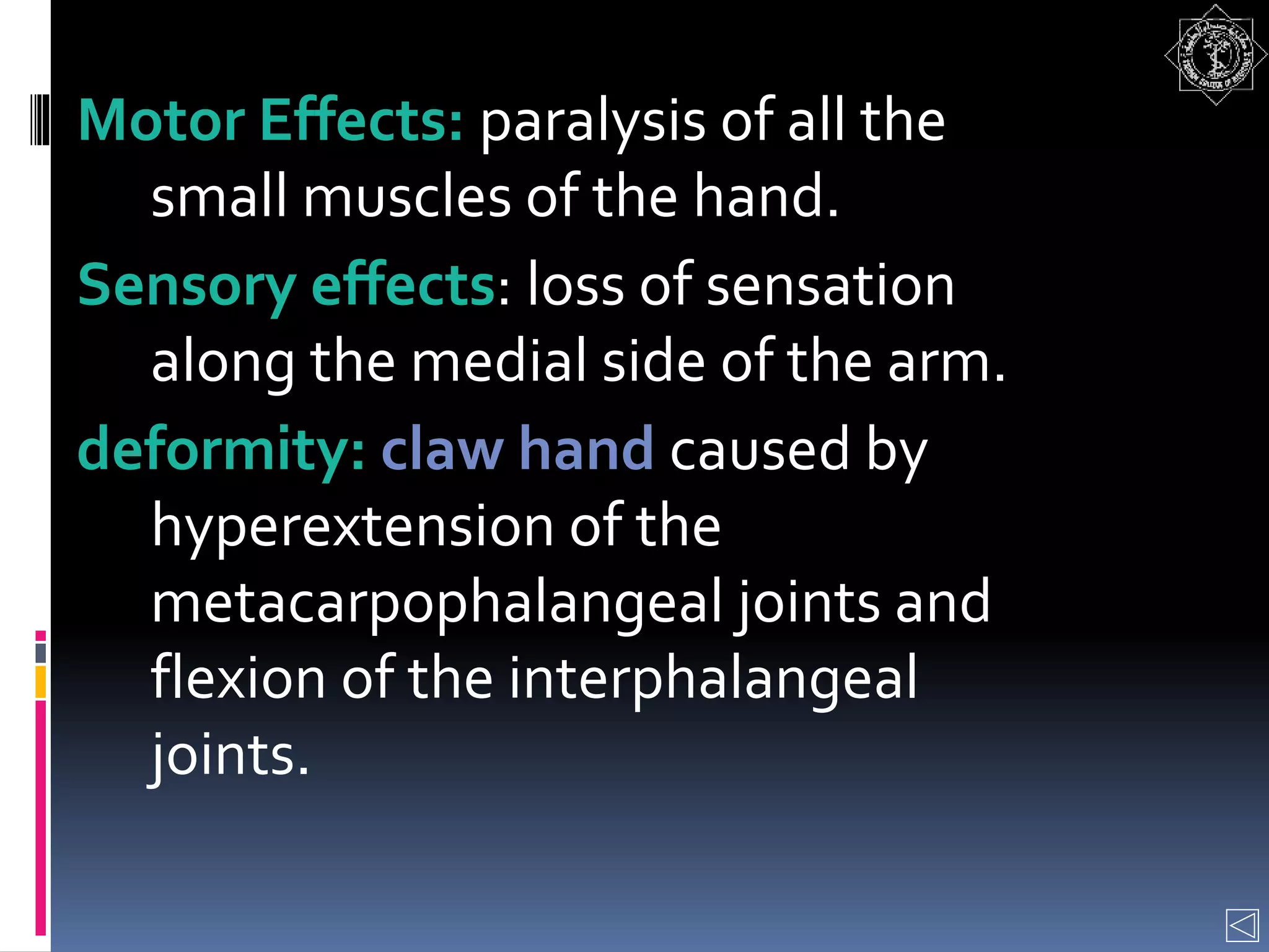 Motor Effects: paralysis of all the
small muscles of the hand.
Sensory effects: loss of sensation
along the medial side of the arm.
deformity: claw hand caused by
hyperextension of the
metacarpophalangeal joints and
flexion of the interphalangeal
joints.
 