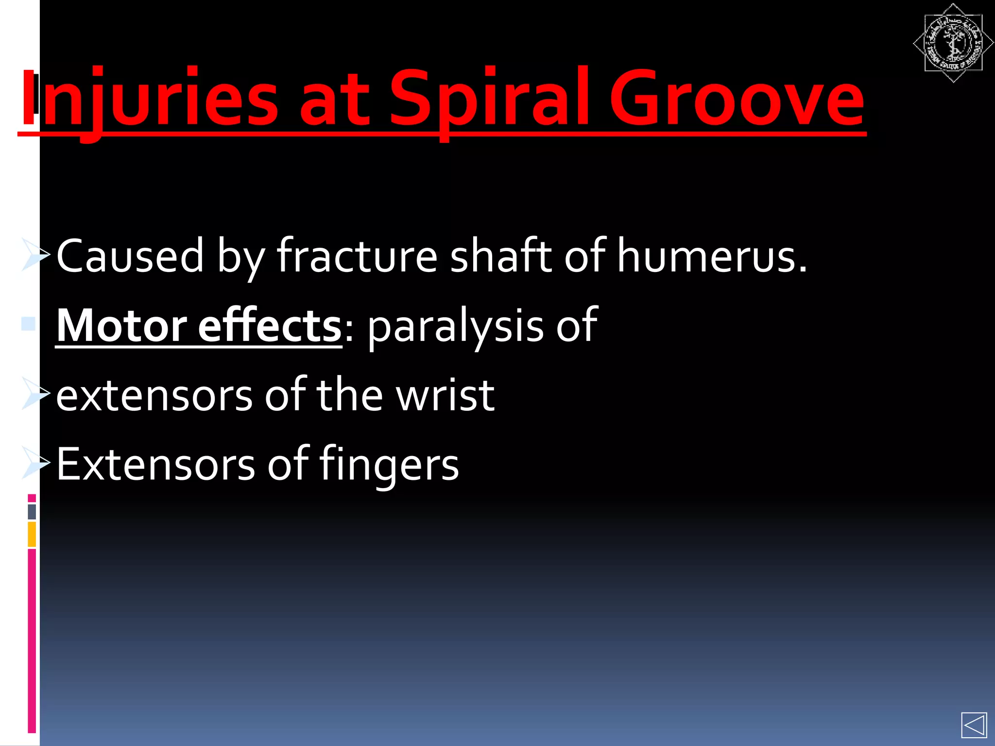 Injuries at Spiral Groove
Caused by fracture shaft of humerus.
 Motor effects: paralysis of
extensors of the wrist
Extensors of fingers
 