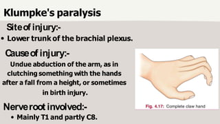 Fall Plexus Event BRACHIAL PLEXUS-2.pptx