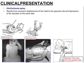 CLINICALPRESENTATION
 