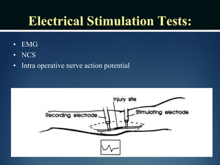 Electrical Stimulation Tests:
• EMG
• NCS
• Intra operative nerve action potential
 